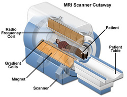 MRI Scan